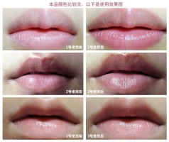 Бальзам для губ [ETUDE HOUSE] Kissful Lip Care