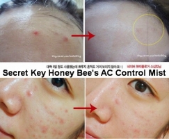 Гель от прыщей с пчелиным ядом [Secret Key] Honey Bees AC Control Spot Remover